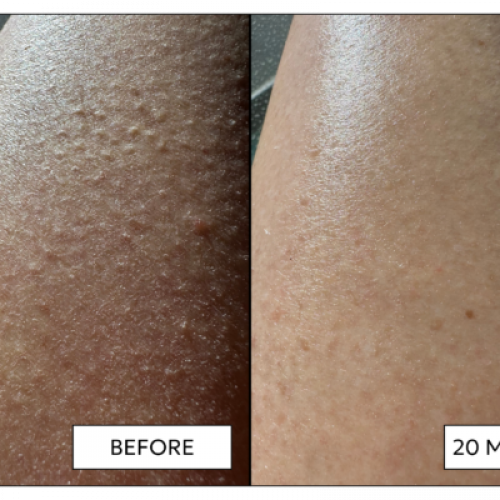 Leg-Facial-new-620x400.png