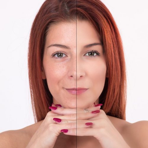 Thumbnail_100_PURE_How_Can_I_Restore_Collagen_in_My_Face_1200x1200.jpg Thumbnail_100_PURE_How_Can_I_Restore_Collagen_in_My_Face_1200x1200.jpg