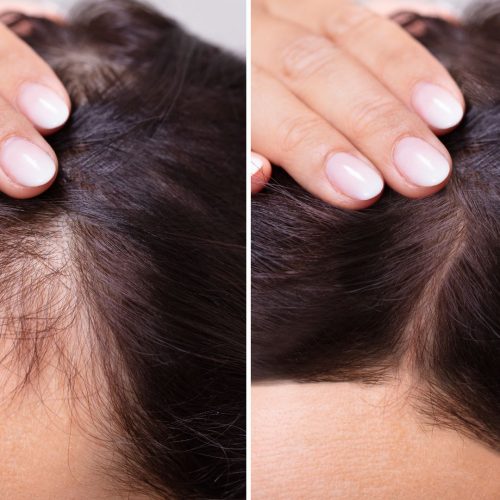 Thumbnail_100_PURE_Natural_Solutions_for_Hair_Loss__Your_Complete_Guide_to_Regrowth_1200x1200.jpg