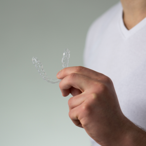 byte-aligners-1024×650.png byte-aligners-1024x650.png