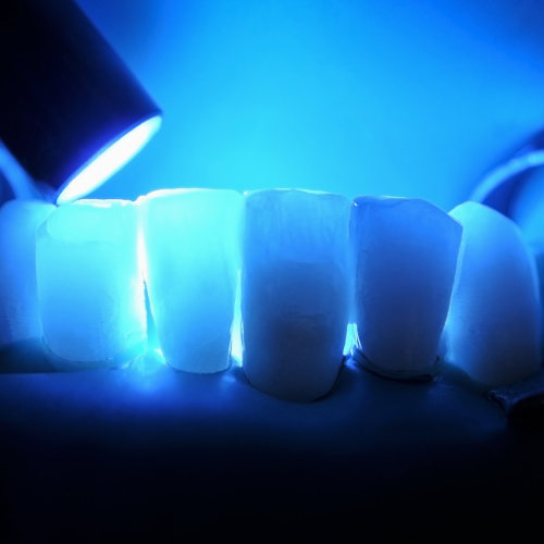 dental-composites.png dental-composites.png
