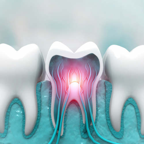 dental-nerves-U-of-M.png dental-nerves-U-of-M.png