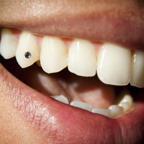 iStock-133893534-e1705417296575.jpg